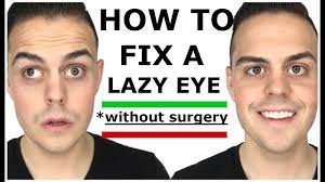 can s fix their lazy eye