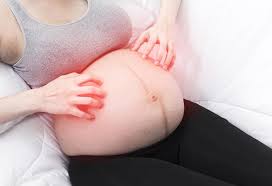 home remes for itching during pregnancy
