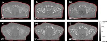 cone beam computed tomography based