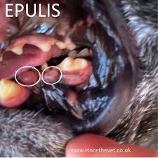epulis what is it and how is it best