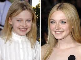 dakota fanning before and after plastic