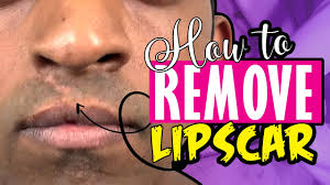 how to remove lip scar improve shape