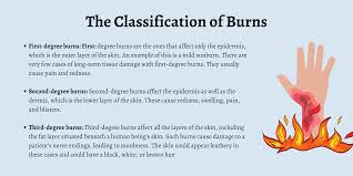 burn injuries