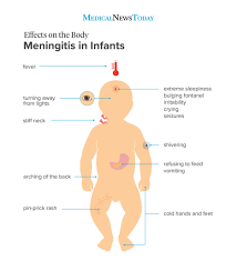 If the problem persists for more than 10 days o. Meningitis Rash Pictures Symptoms And Similar Rashes
