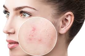 what causes black spots on the face and