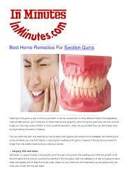 remes for swollen gums