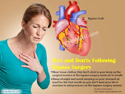 Dos And Donts Following Bypass Surgery