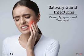 salivary gland infections causes