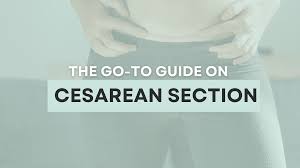 the go to guide for mamas on c sections