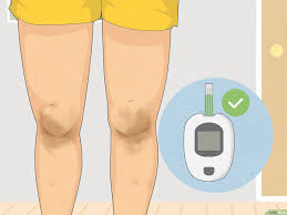 how to lighten dark knees home