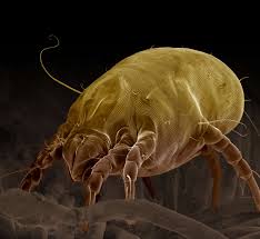 dust mite bites treatment symptoms