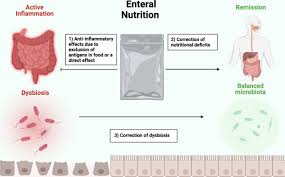 review of exclusive enteral therapy in
