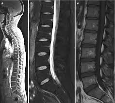 spine radiology key