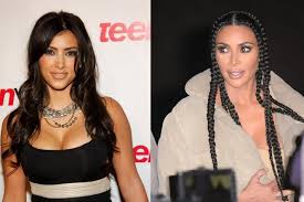 Przyznanie się do poprawiania urody bywa trudną decyzją. Kim Kardashian Dostala Ultimatum Wytrzyma Bez Operacji Plastycznych Sonda Eska Pl