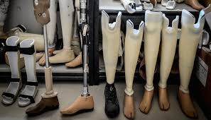 Resultado de imagen para protesis de pierna