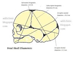 Fetal Skull Diameters Skull
