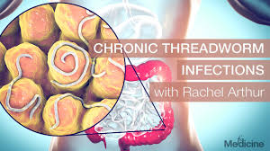 Pinworms are more common than ever imagined. Chronic Threadworm Infections With Rachel Arthur Fx Medicine