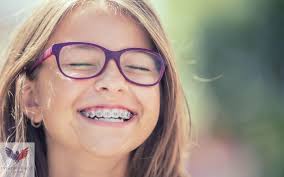 Jul 26, 2021 · when it comes to braces and orthodontics, it is important to know what your dental insurance covers and what different coverage exists for both children and adults. 7 Important Insurance Questions To Ask Before Adolescent Braces Intrepid Eagle Finance