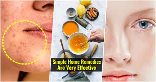 10 home remes to remove dark spots
