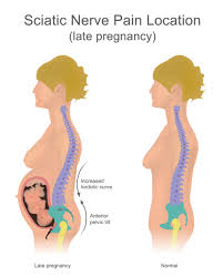 back pain during pregnancy treatment