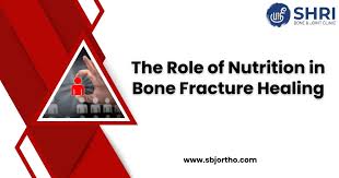 nutrition in bone fracture healing