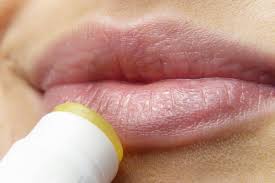 is carmex good or bad for your lips