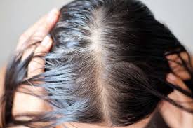 tingling scalp sensation causes and