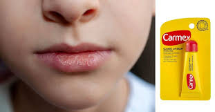 is carmex good for dry lips lip therapy