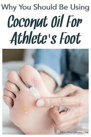 coconut oil for athlete s foot tinea