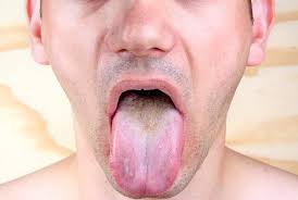 3 Colors Your Tongue Should Not Be Health Essentials From