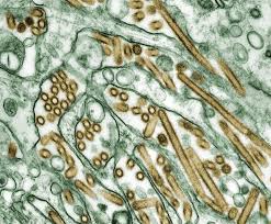 Causes and risk factors of bird flu. Influenza A Virus Subtype H5n1 Wikipedia