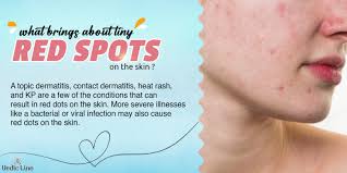 red spots on the skin let s learn
