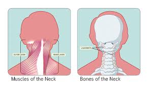 stiff neck causes conditions