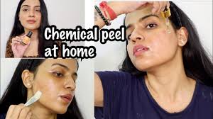 CHEMICAL PEEL AT HOME | How To Do Chemical Peel At Home | Chemical Peel  Treatment India - YouTube