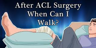 after acl surgery when can i walk 10