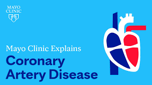 coronary artery disease symptoms and