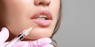 tips to reduce lip filler swelling in