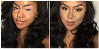 camouflage makeup for severe skin