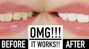 whiten teeth instantly with makeup