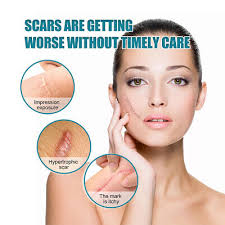 silicone scar cure patch soft section