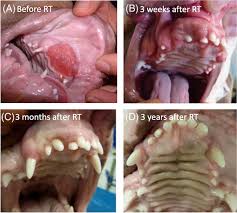 treatment of canine papillary