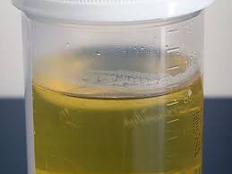 what s the normal color of dog urine