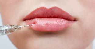 plump thin lips with fillers dr