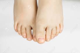 These bacteria produce more than just stinky organic acids — they also produce stuff . Dirty Feet Of A Little Boy S Feet Dirt Under The Fingernails On A White Background Stock Photo Picture And Royalty Free Image Image 95189426