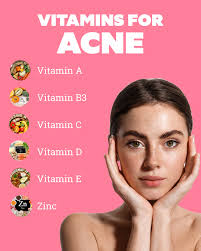 best vitamininerals for acne