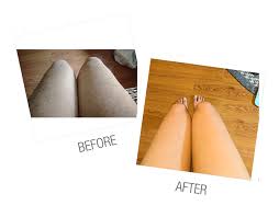 However, precautions like avoiding sun exposure or tanning of any kind, foregoing exfoliating until after the hair sheds, and taking a however, costs vary widely depending on your treatment area. Full Leg Laser Hair Removal Vs Medspa Laser Clinic