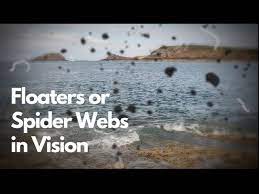 seeing floaters or spider webs in