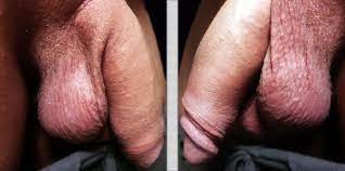 File:Flaccid uncircumcised penis.png - Wikimedia Commons