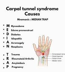 Learn causes of carpal tunnel syndrome - MEDizzy