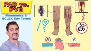 Peripheral Arterial Disease Top Tested Signs Symptoms For Peripheral Vascular Pad Vs Pvd Memo
